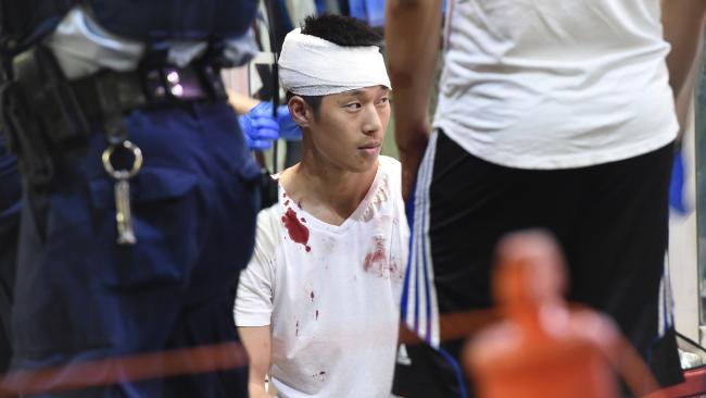 悉尼希尔顿酒店外发生群殴 亚裔男头受伤