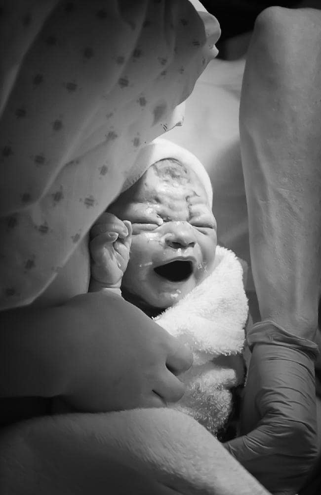昆士兰最大医院禁止专业摄影师拍摄分娩